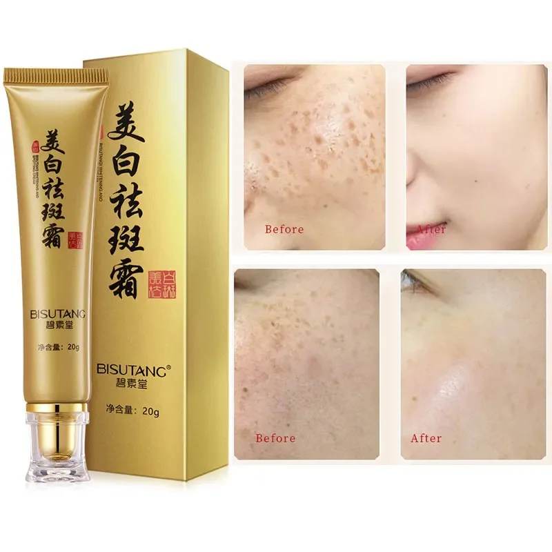 Whitening Freckles Cream Remove Dark Spot Face Cream Lighten Melasma Melanin Pigmentation Anti-Aging Moisturizing Brighten Skin