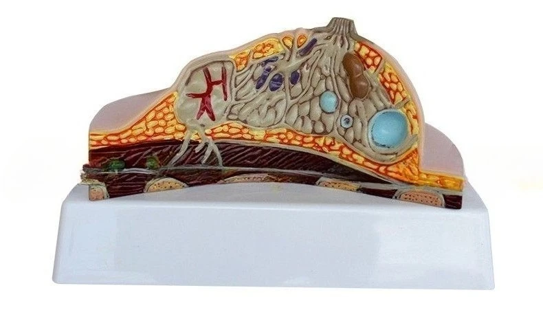 Breast pathological anatomy model