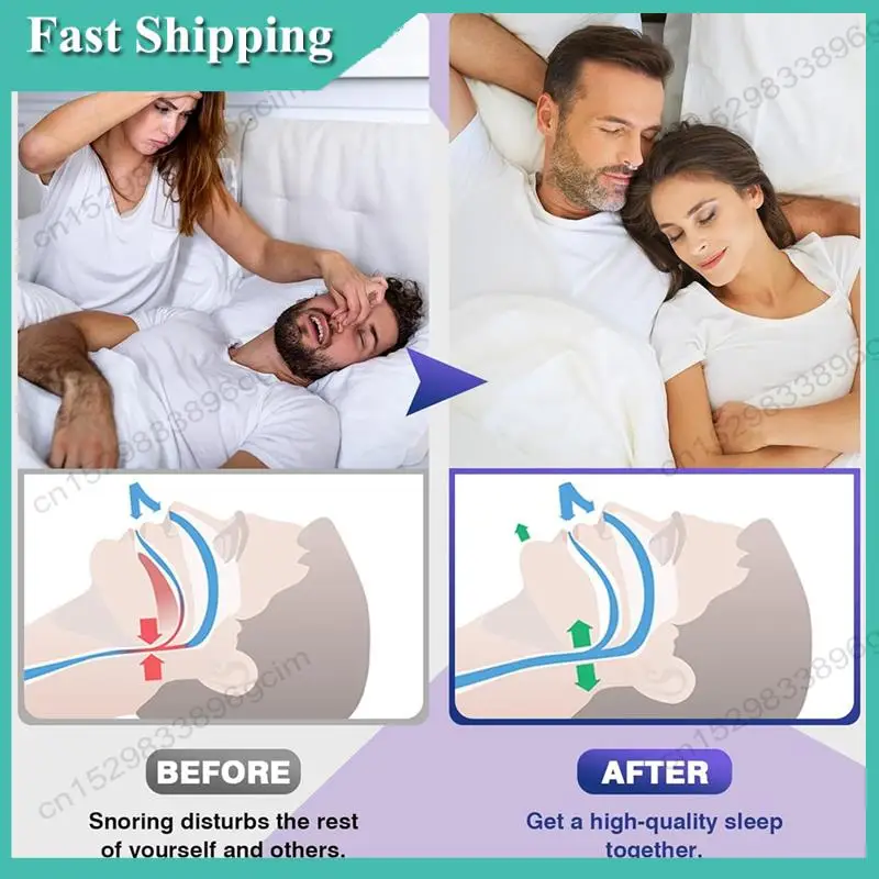 

-BABQ Anti Snoring Devices, Snore Stopper With Adjustable Magnet, Snoring Solution For Comfortable And Quieter Sleep, 8PCS