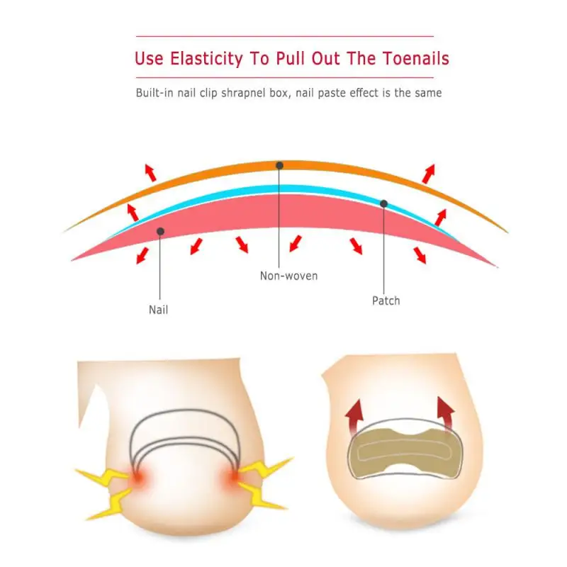 1/3/5PCS strumento per la cura dei piedi sollievo dal dolore facile da usare senza colla Premium Pedicure efficace strumento per Pedicure paronichia