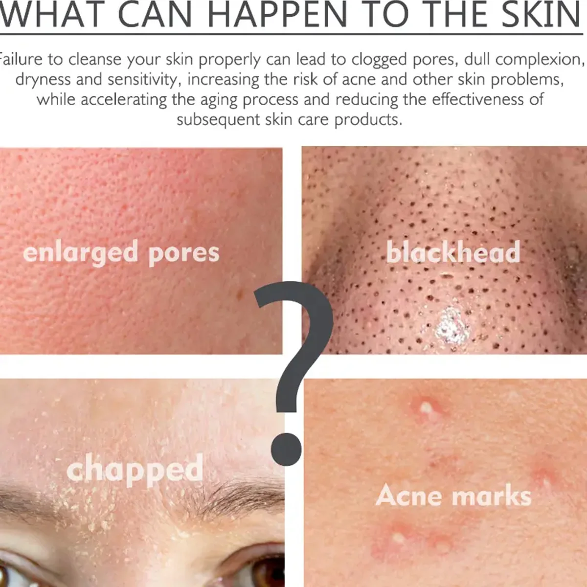 جوهر الوجه مع حمض الساليسيليك ، وتقليص المسام ، لتفتيح البقع ، وتقليص المسام ، ولون البشرة والتحكم في الزيت #4