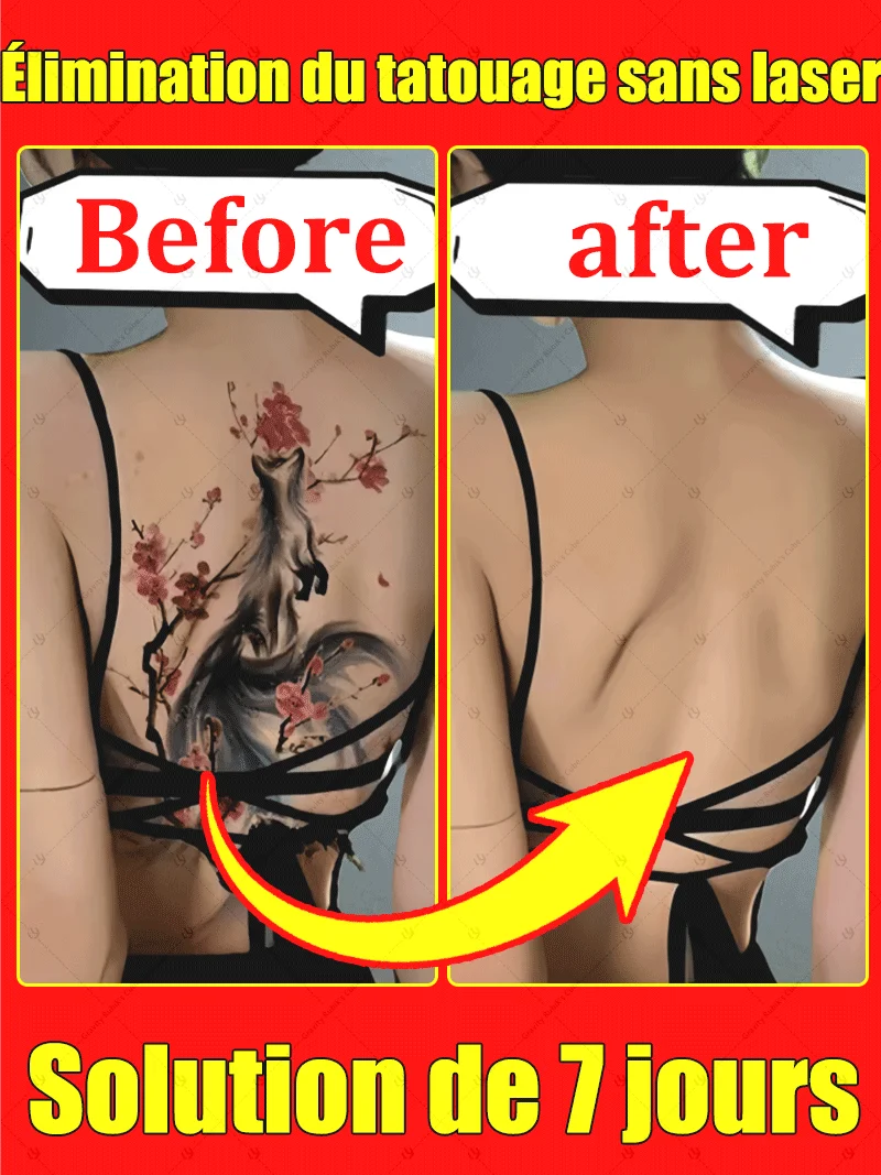 : Ferramentas de pedicure