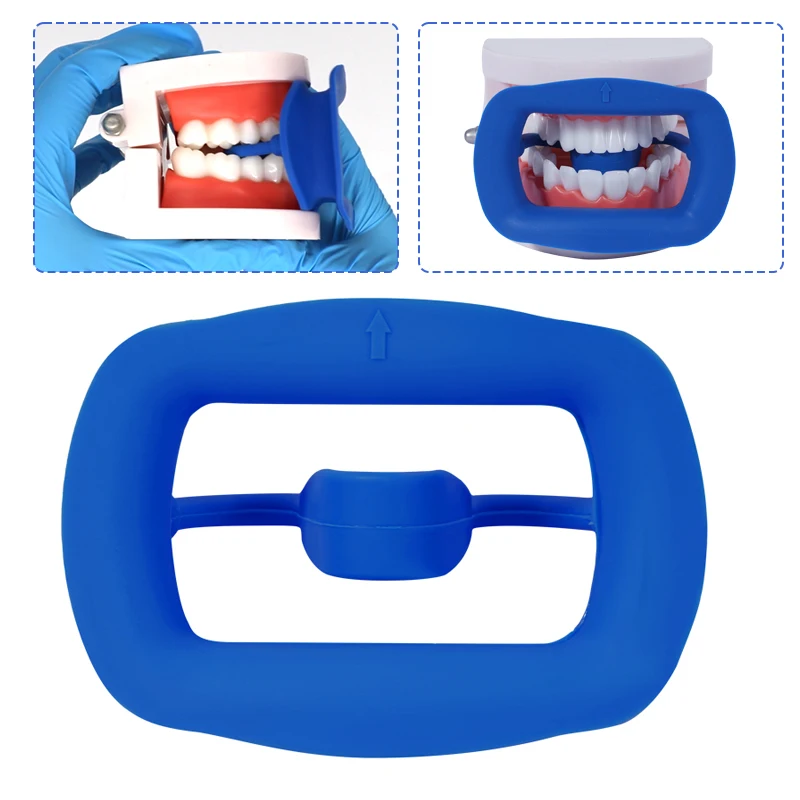 1pc Dental Mouth Opener 3D Soft Silicone Lip Cheek Retractor Expander Oral Care Teeth Whitening Dentist Materials