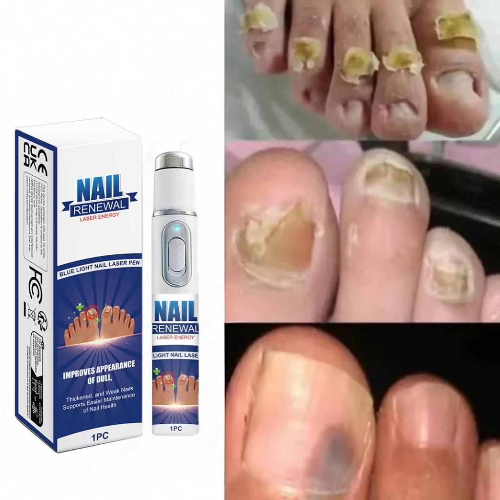 

2025 Hot Sellers:Laser pen blue light pen maintain a healthy body