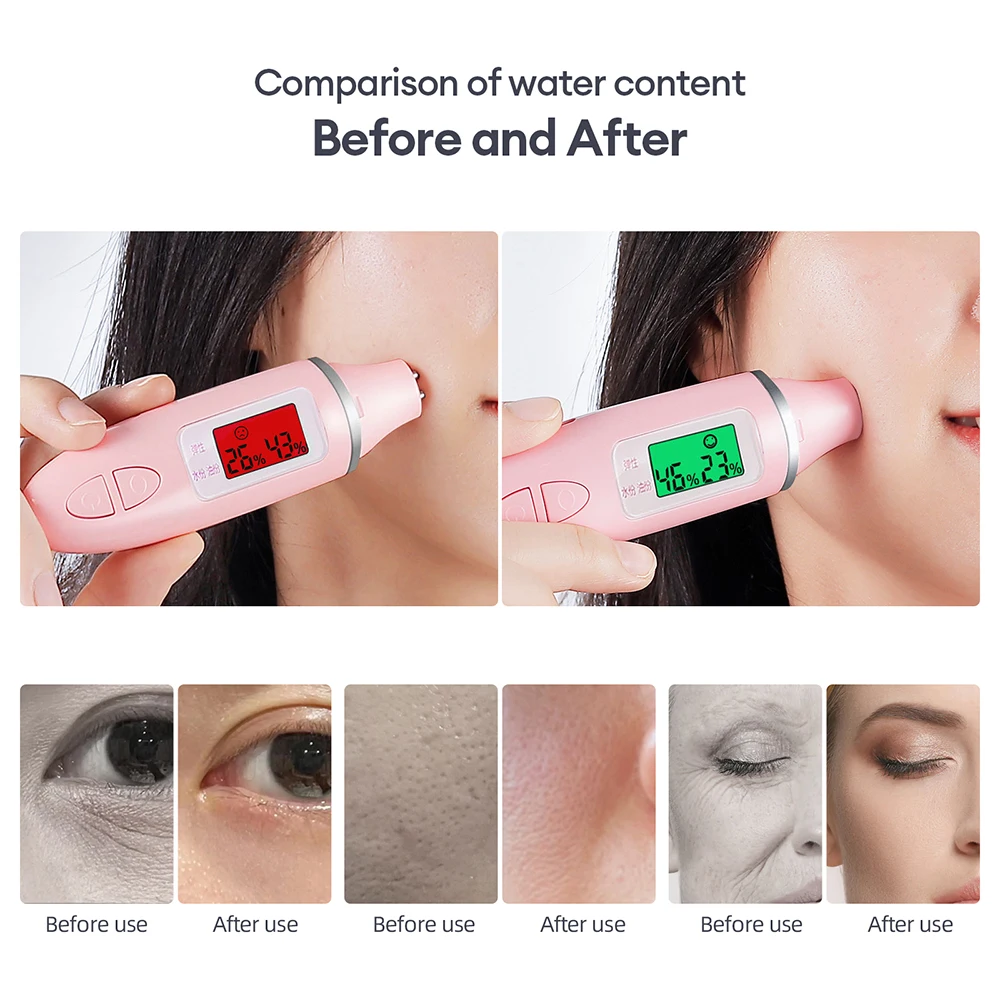 Oxygen Bubble Pen CO2 Oxygen Handheld Portable Facial Oxygen Bubble Beauty Device Tighten Skin And Eliminate Puffiness Skin Care