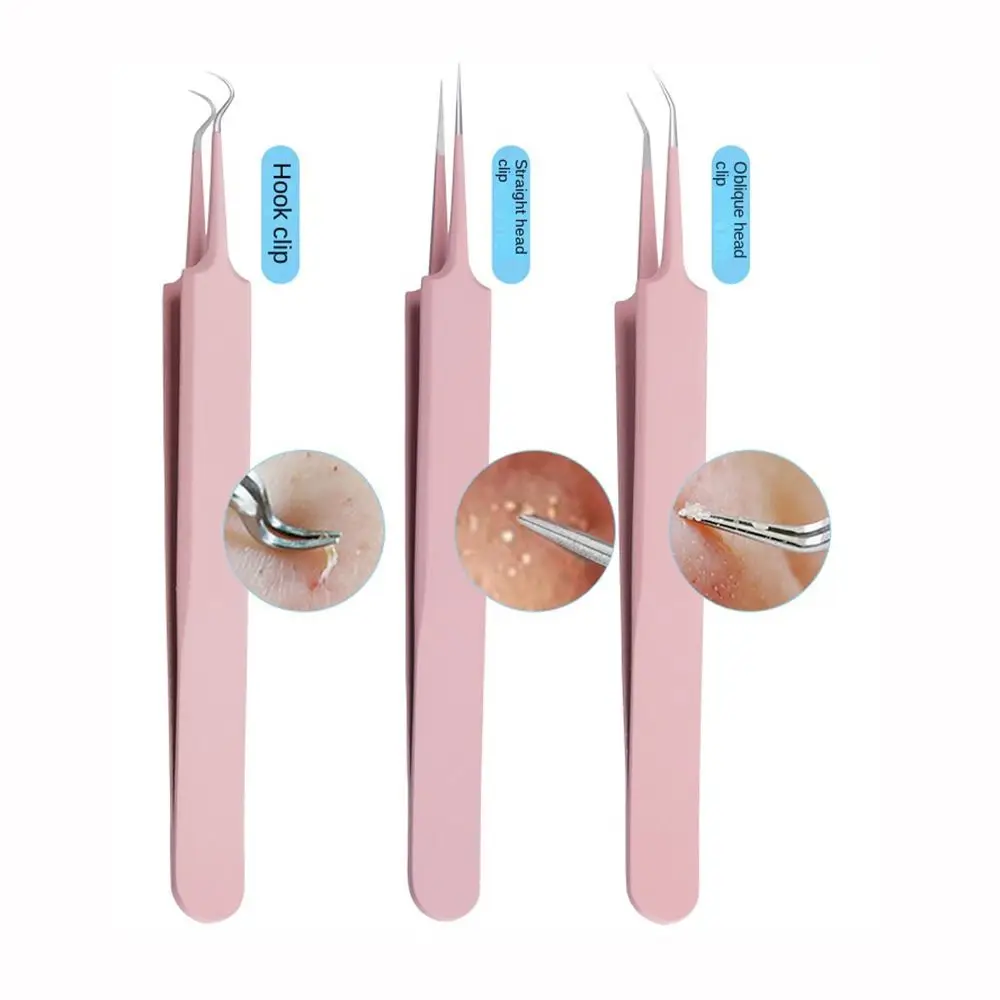 Brufoli cellulari ultrafine Clip per punti neri Strumento portatile leggero per la rimozione dell'ago per l'acne Facile da usare in acciaio inossidabile