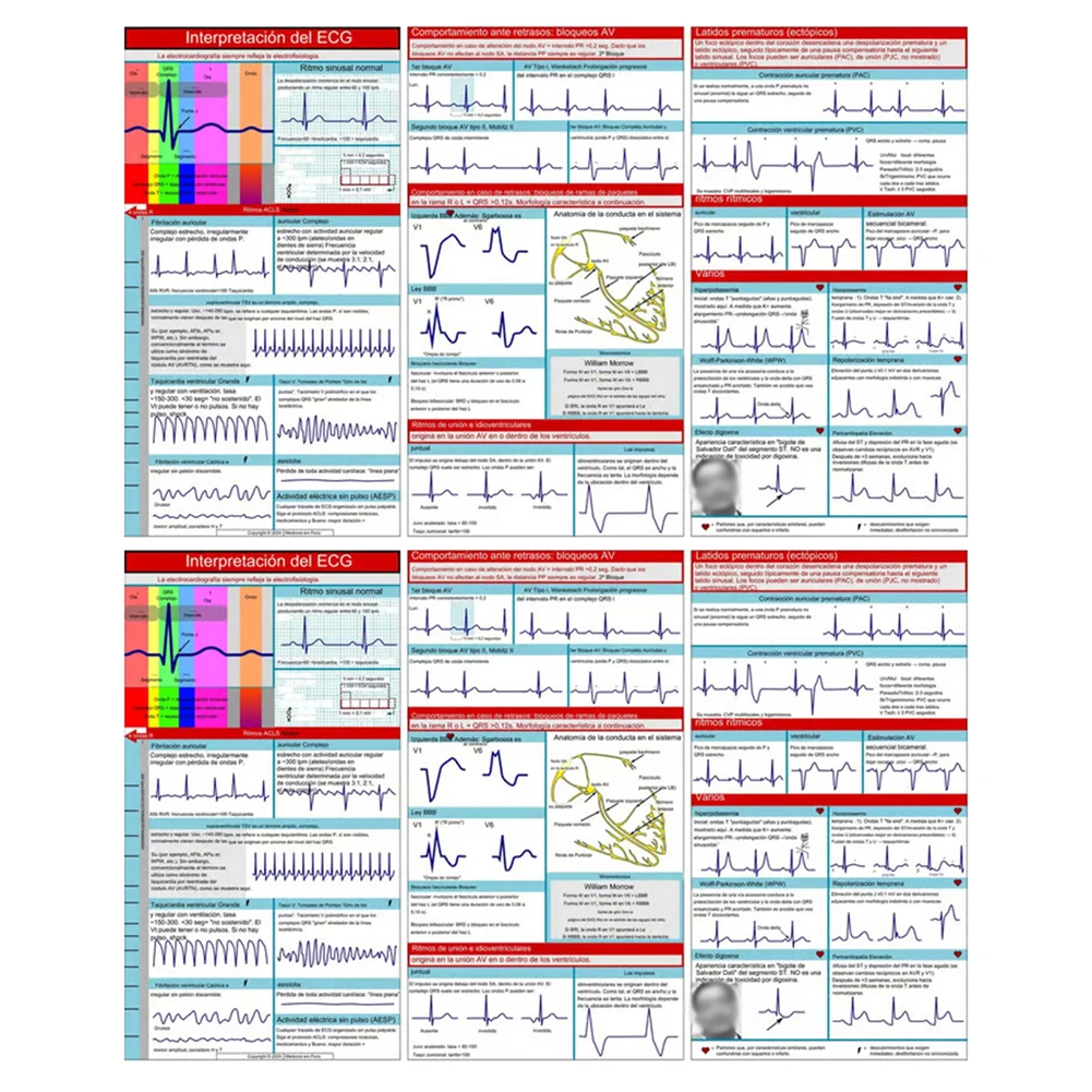 Self Test Ruler Pocket Card for Rapid Diagnosis and Examination Review Essential Resource for ACLS Rhythm Analysis