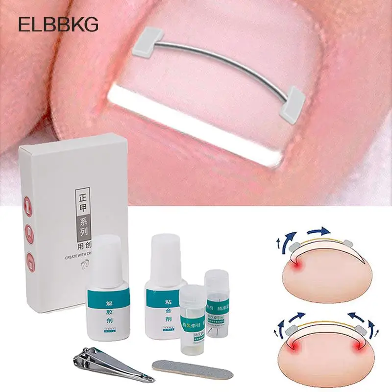 Ingrown Toenail Corrector Tools Pedicure Recover Embed Toe Nail Treatment Professional Ingrown Toenail Correction Foot CareTool