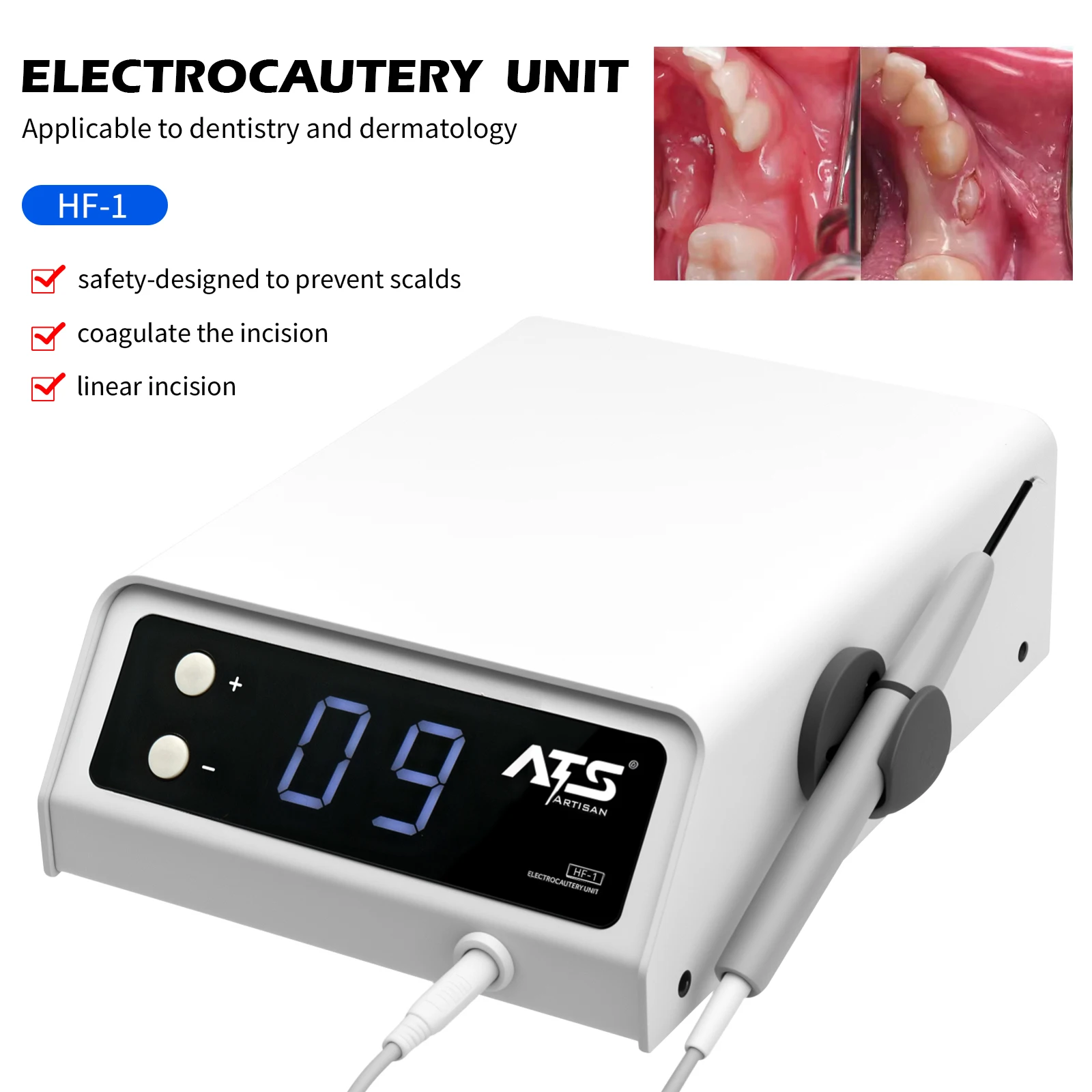 

High Frequency Portable Dental Oral Surgery Electric HF-1 Knife Electrosurgery 10Tips Applicable Dentistry & Dermatology