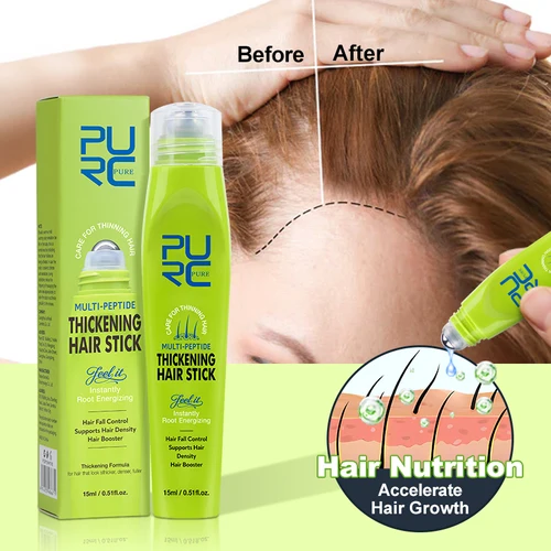 PURC biotina aceite para el crecimiento del cabello engrosamiento adelgazamiento antipérdida de cabello tratamiento del cuero cabelludo productos para el crecimiento del cabello para hombres y mujeres cuidado del cabello