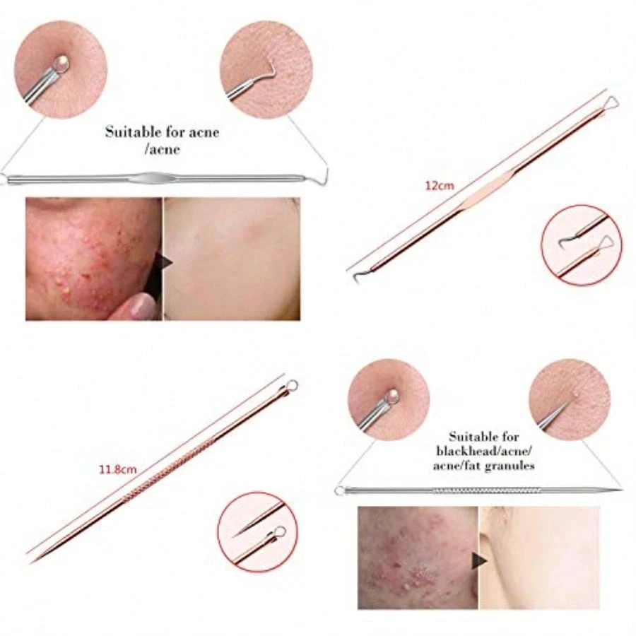 4Pcs Stainless Steel Blackhead Remover Pimple Popper Tools ,Acne Comedone Zit Blackhead Extractor Tool For Nose Face