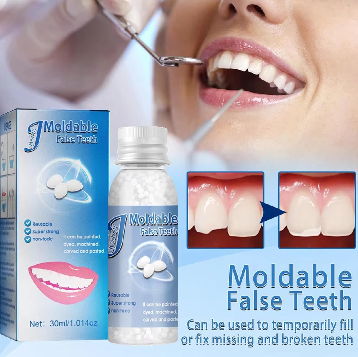 1/2/4 Flaschen Temporäre Zahnreparatur Formbares Gel für Zähne und Lücken Falscher Zahn Festes Gel-Klebstoff Künstliche Zähne Schönheitswerkzeug Dentalbedarf