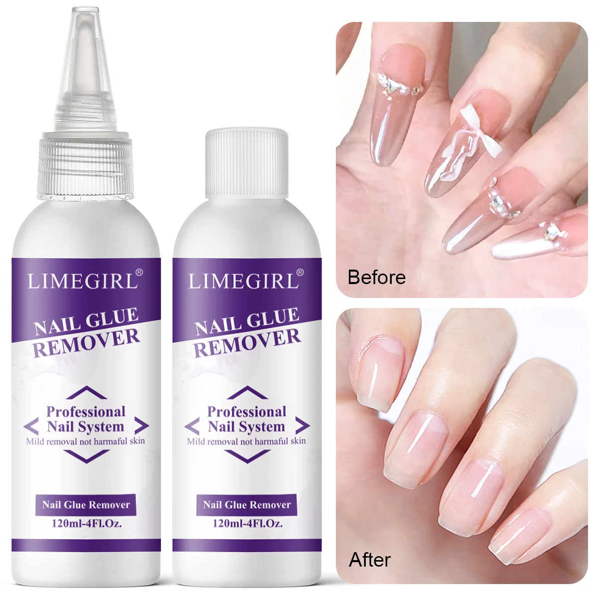 

LIMEGIRL Средство для снятия клея для ногтей Press on Nail 10/120 мл Средство для снятия ногтей Easy Removal Debonder для клея на кончиках ногтей Поставки