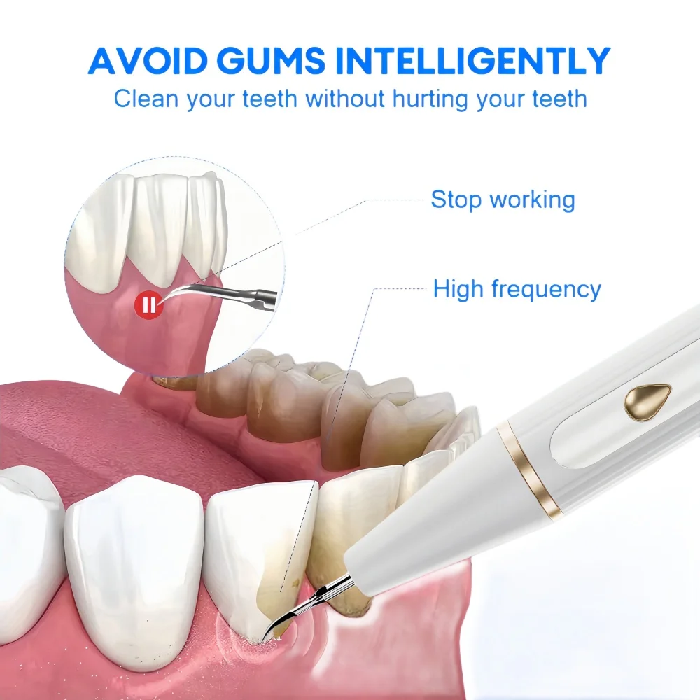 مبيضة أسنان بالموجات فوق الصوتية لإزالة الجير الأسنان الكهربائية منظف الأسنان حساب التفاضل والتكامل مزيل البلاك إزالة حجر الأسنان #3