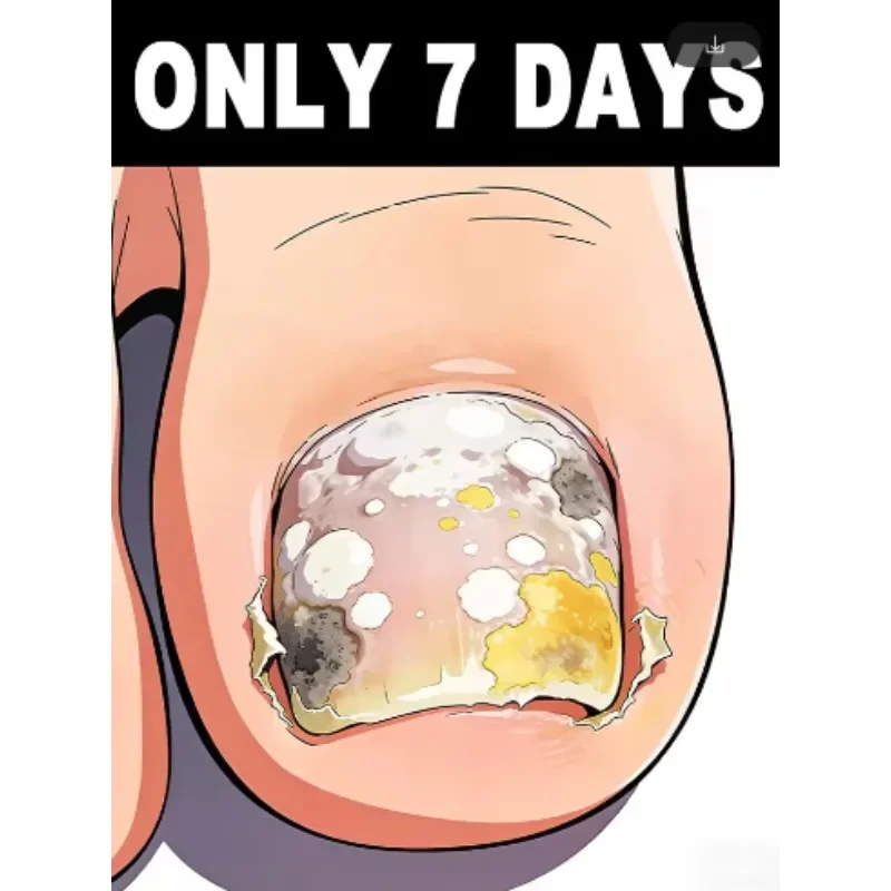 

Don't hesitate, take action now!ᔆᵃʸ ᵍᵒᵒᵈᵇʸᵉ ᵗᵒ ᵒⁿʸᶜʰᵒᵐʸᶜᵒˢⁱˢ!