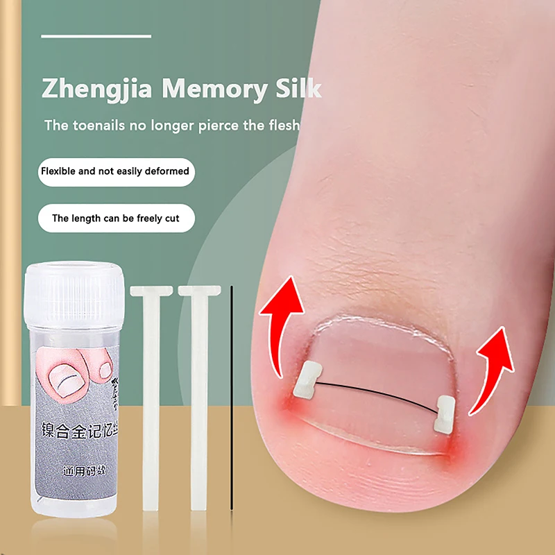 Universal Croppable Ingrown Toenail Straightening Clip Elastic Patch Toe Nails Care Corrector Patch Brace Pedicure Tools