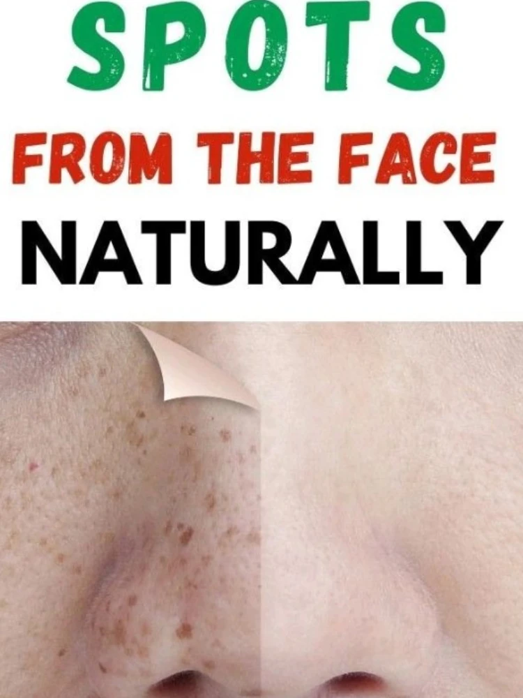 

Whitening Lightening Spot Essence To Lighten Chloasma Replenish Water Moisturize Brighten And Beautify Skin Whitening Serum