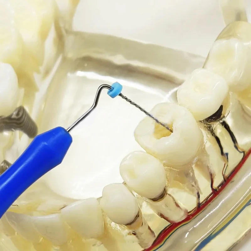 Mikroskop dentystyczny pilnik do kanałów korzeniowych pilnik H pilniki K sonda czyszcząca akcesoria do pomiaru endodontycznego stożek