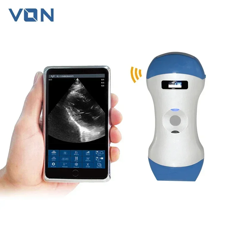 

2025/VON Wireless Portable Veterinary Color B Ultrasound Scanner Animal Dog and Cat Ultrasound