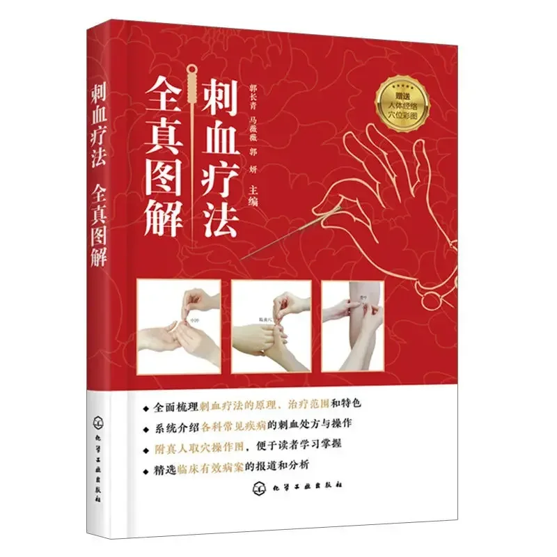 

Complete Picture of Blood Pricking Therapy, Book of Blood Pricking Therapy, Complete Book of Blood Pricking Therapy In China