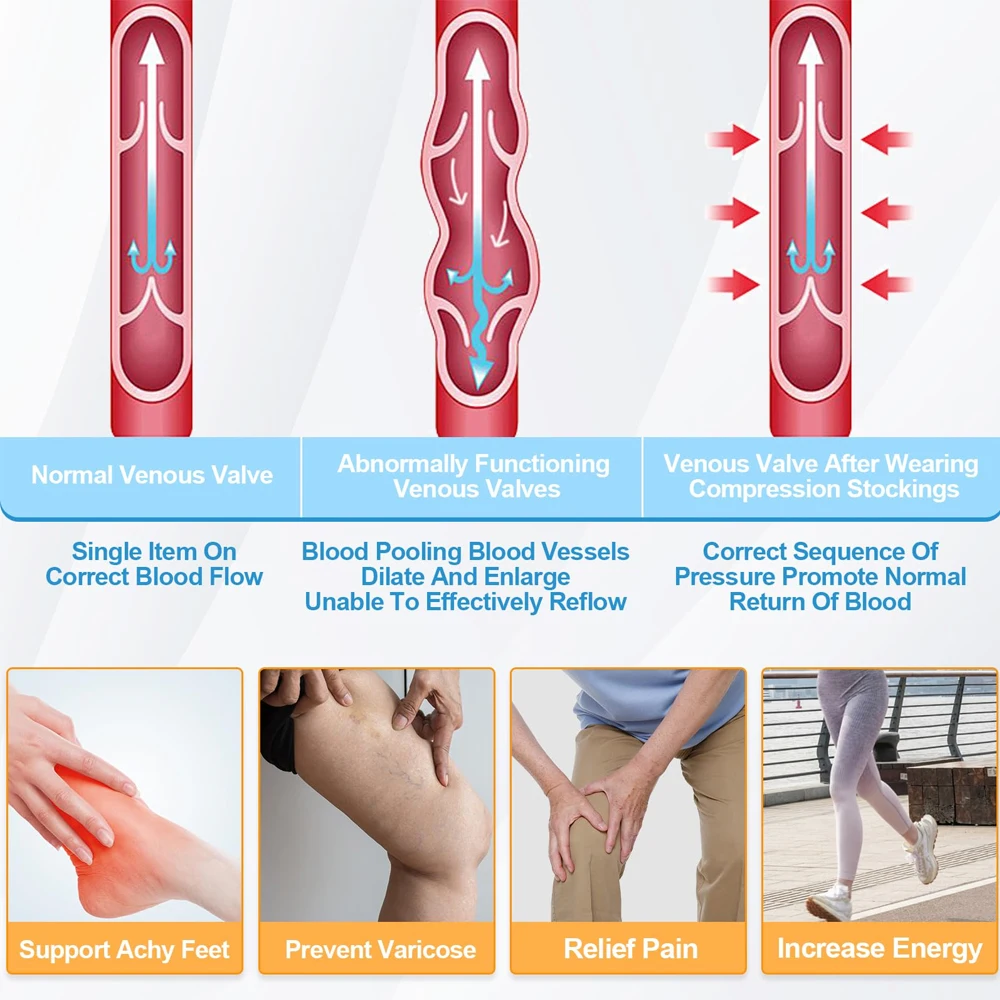 1 Paar Ted Hose Oberschenkelhohe Anti-Embolie-Kompressionsstrümpfe für Frauen und Männer, chirurgische Kompressionsstrümpfe, 15-21 mmHg – Detail 6