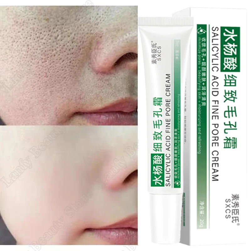 

Salicylic Acid Pore Clearing Cream Shrink Pores Remove Blackheads Acne Brighten Moisturizing Smooth Skin Care Korean Products
