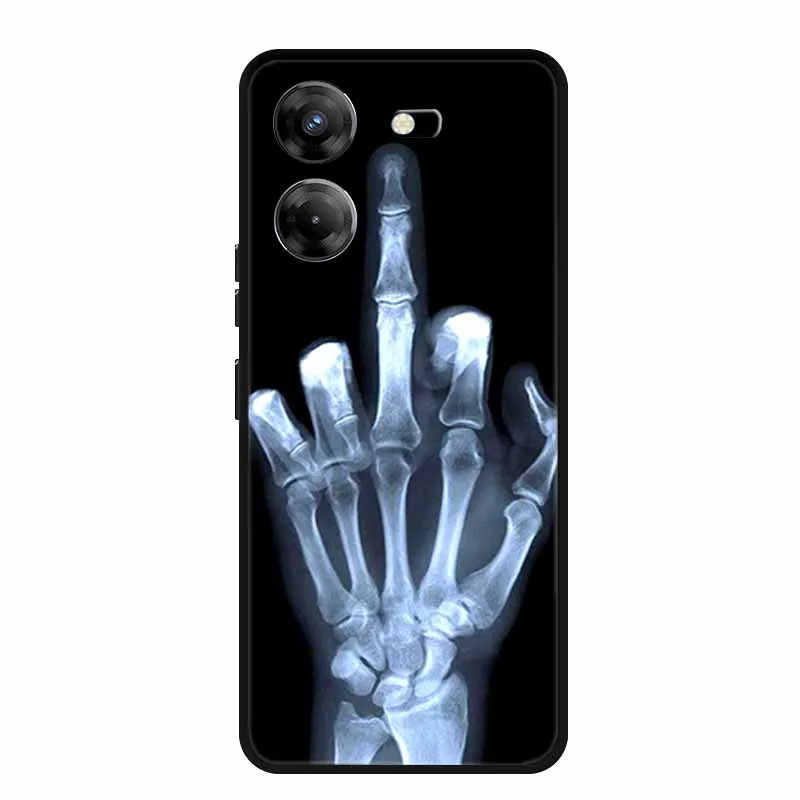 For Tecno Pova 5 Case Pova5 Phone Cover Shockproof Black Silicone Soft Back Cover Case For Tecno Pova 5 Phone Case Funda Coque