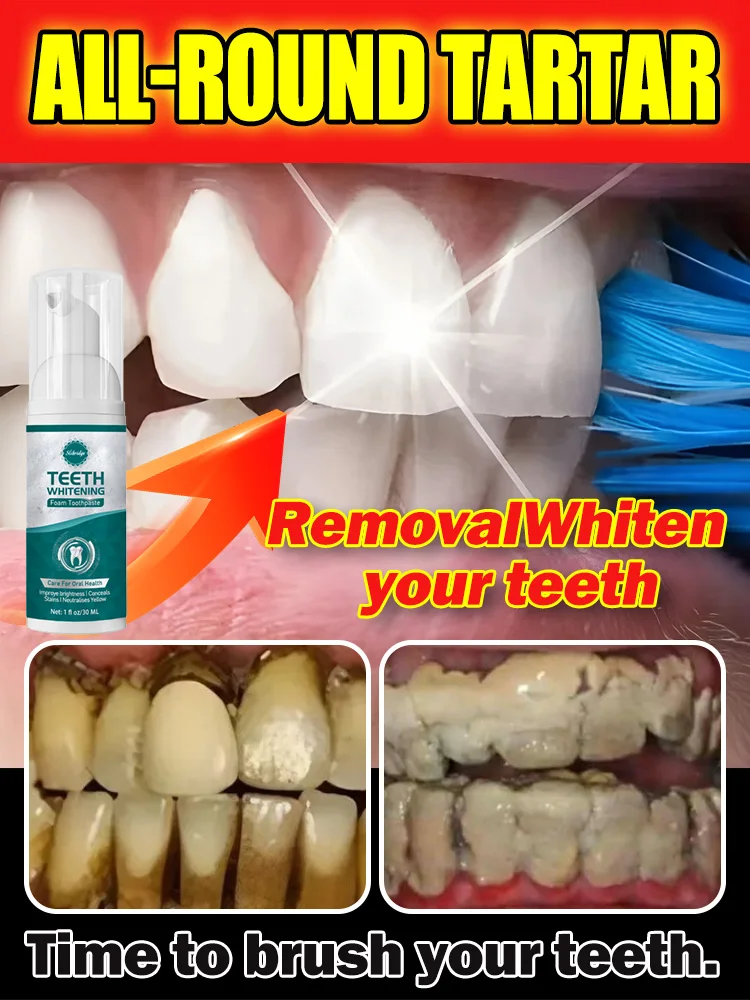 

Dental care, removal of stains, stones, fresh breath