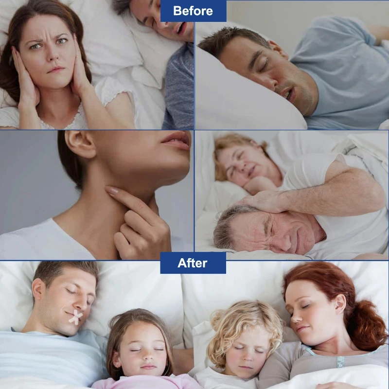 Anti Snoring Mouth Tape Transparent Sleep Strips Stickers Better Nose Breathing Improved Nighttime Sleep Less  Snoring Lip Patch