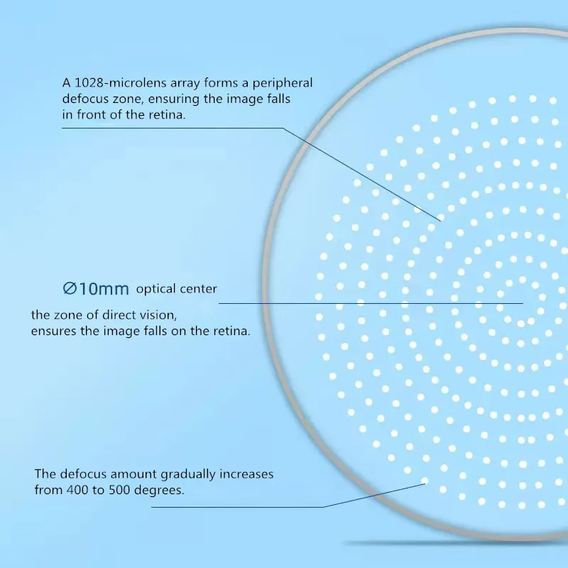 Multi Point Defocus Anti-blue Light Lenses Children Teenager Eyes Relief Protection Myopia Control Optic Prescription Micro Lens