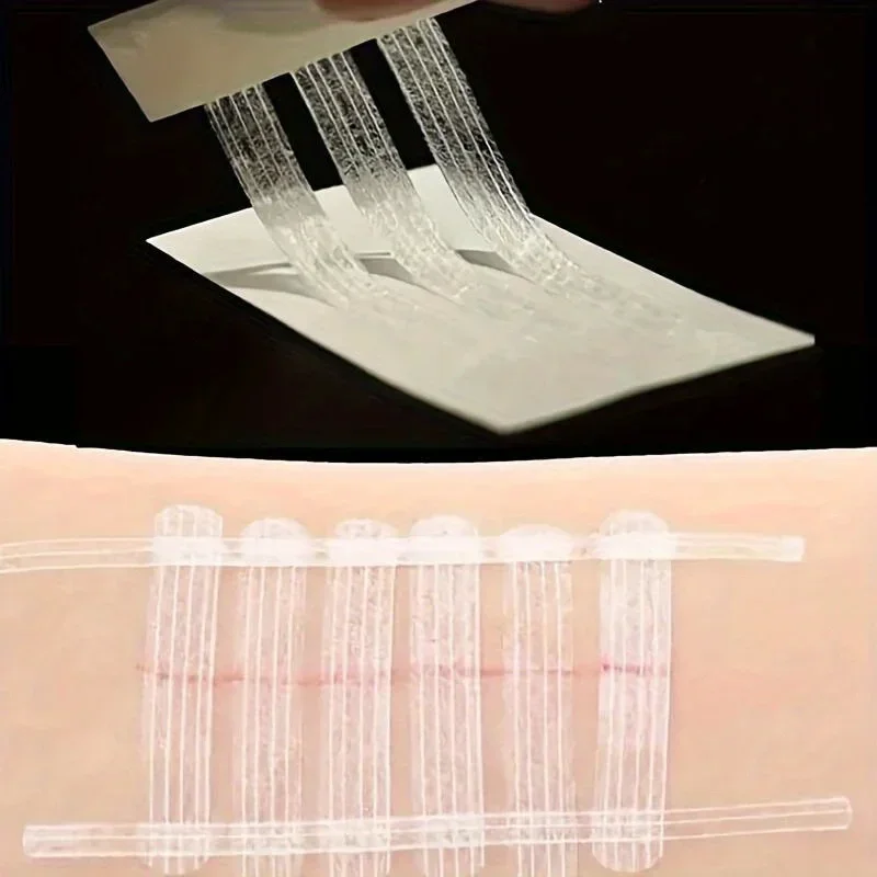 5 Strips Wound Skin Closure Strips Postpartum Wound Repair Cosmetic Surgery Strip Adhesive Medical Suture Free Surgical Tape view 3