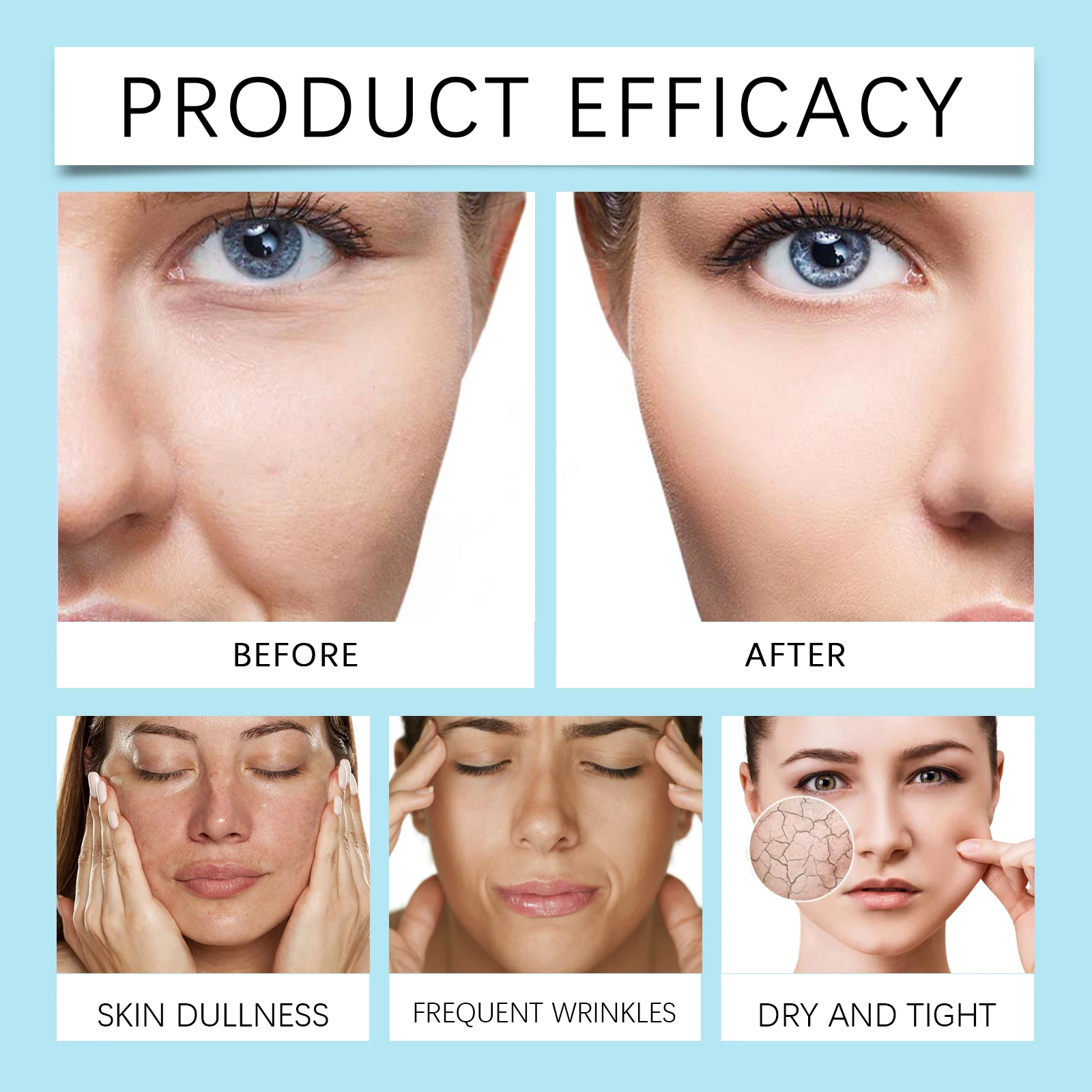 كينتيللا كريم ترطيب نهائي تركيبة شبابية الكولاجين نياسيناميد كينتيللا اسياتيكا حمض الهيالورونيك التجاعيد البقع كريا