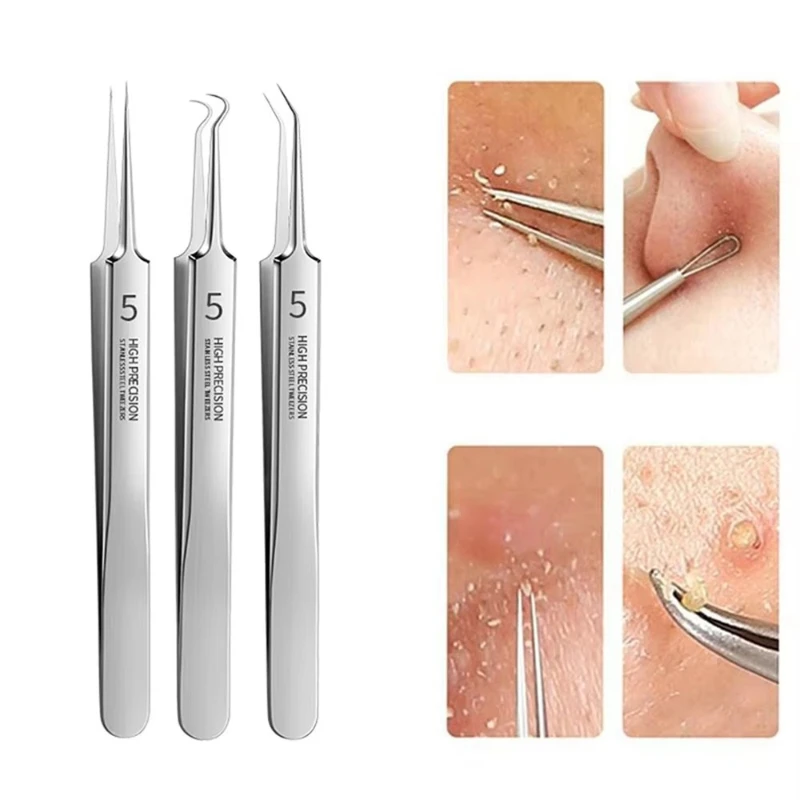1/2/3/4pcs Extra Fine No. 5 Cellular Acne Blackhead Tweezers,Facial Beauty Remove Acne Needle Tools For Skin Care,Blackhead Clip