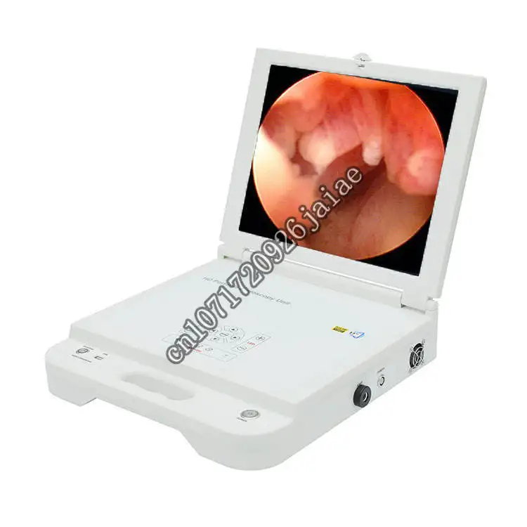 Portable Laptop Endoscopy  All in One Full HD Endoscope  System for Laparoscope Hysteroscopes ent with recorder