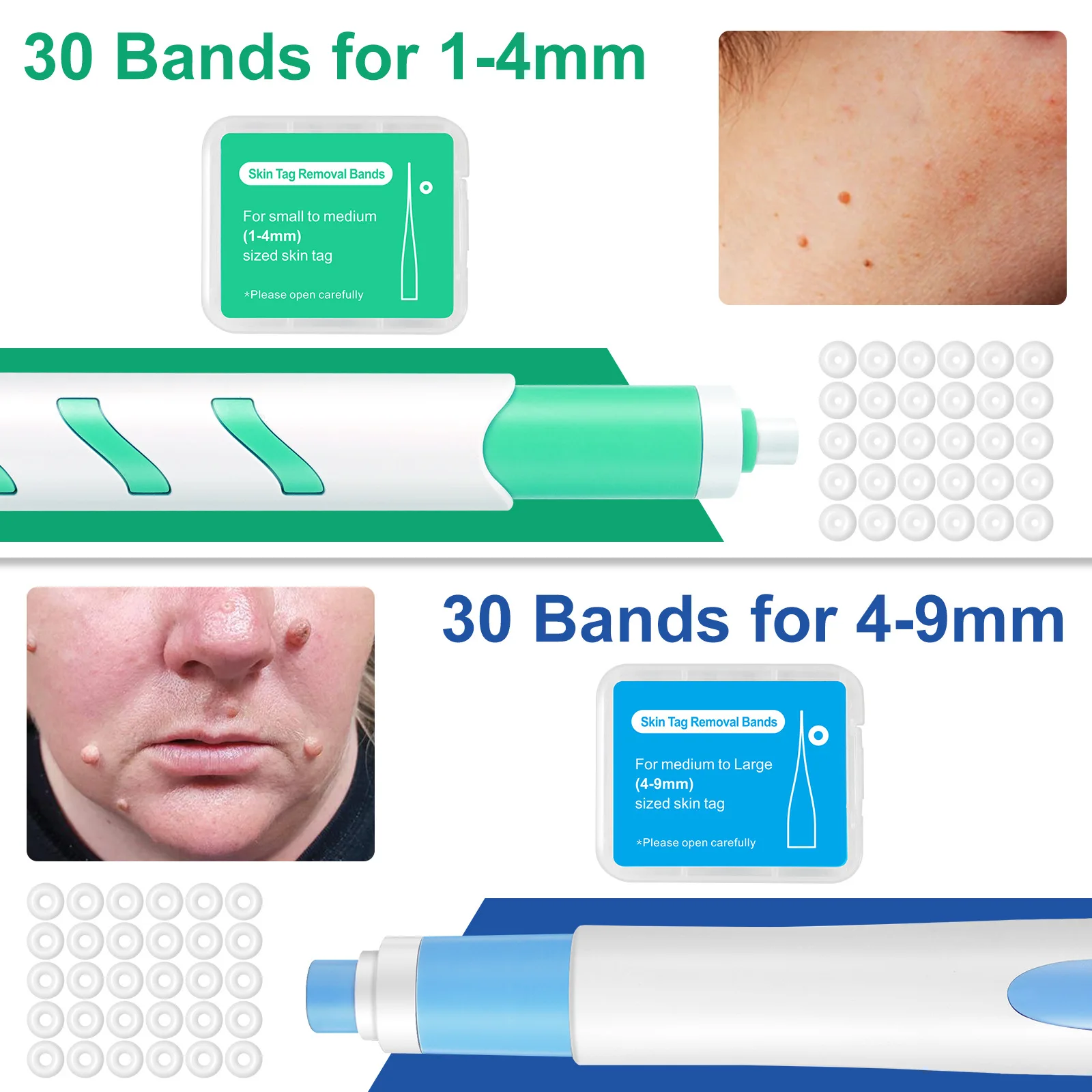 2-IN-1 السيارات الجلد علامة أداة إزالة الصواميل عدة 2 قطعة حب الشباب ثؤلول إزالة القلم ل 1-9 مللي متر مع مسحات التطهير أدوات العناية ببشرة الوجه غير مؤلم #6