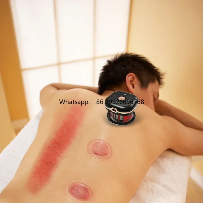 

High Quality New Tech Electric Cupping Machine Infrared Vacuum Cupping Cups For Hijama With Big Suction factory