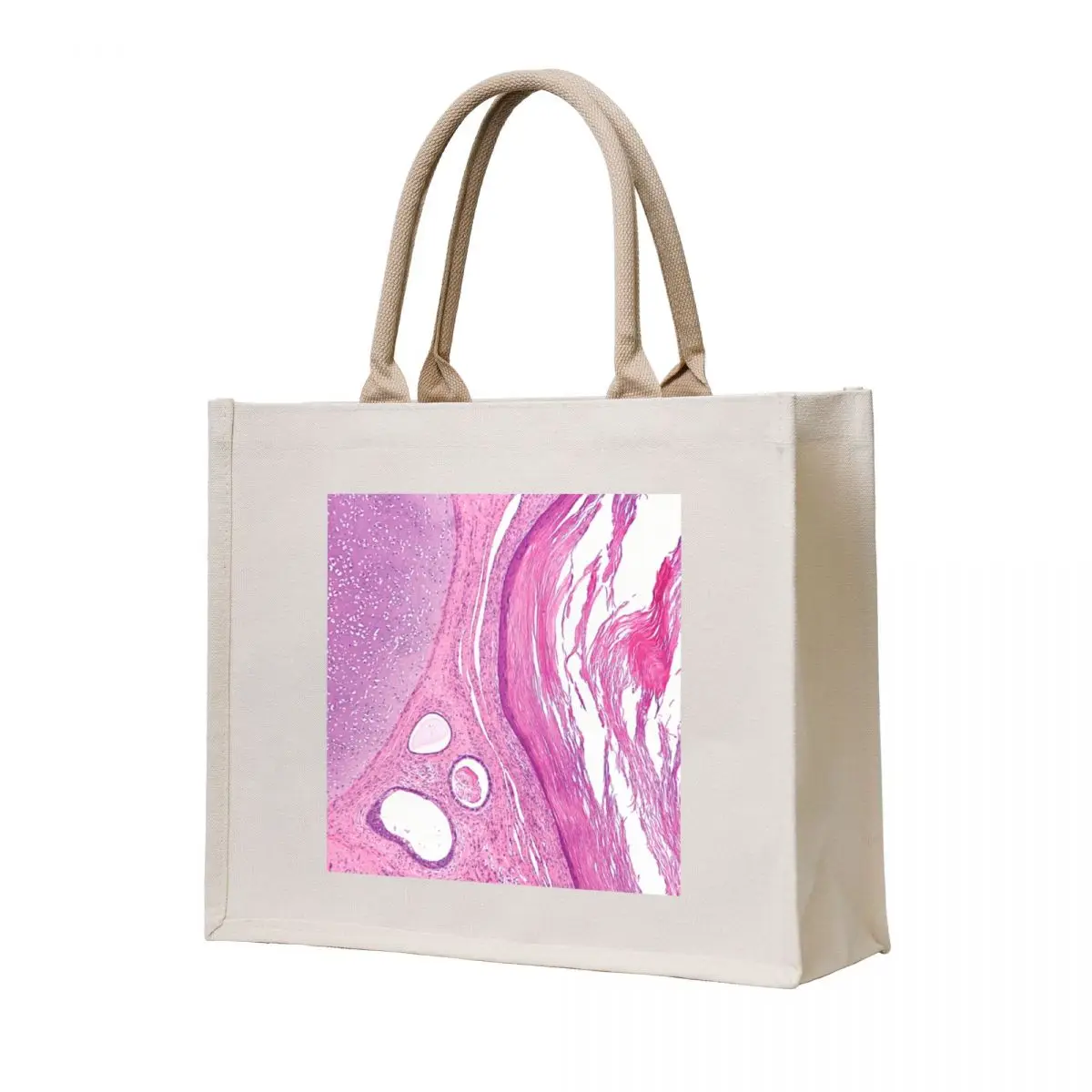 

Teratoma Histology Tote Bag shopping cart bags free delivery bags Women's beach bags sac pour femme