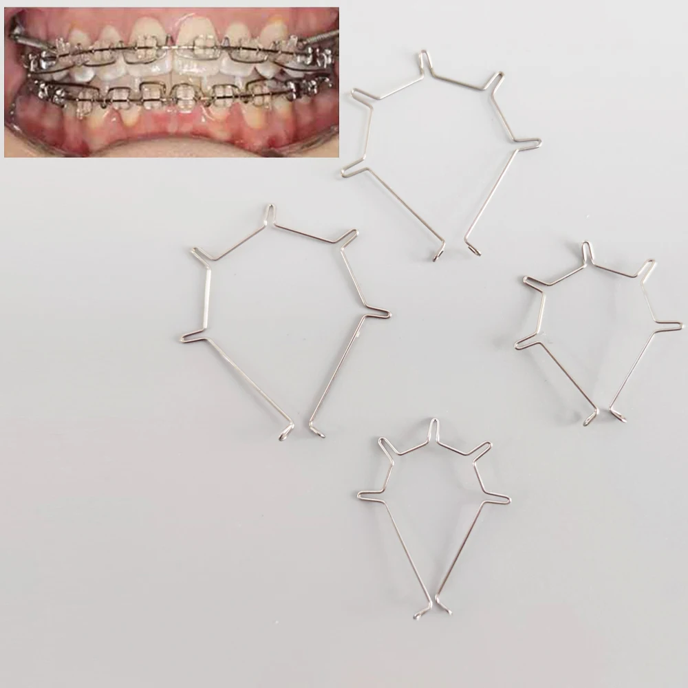 Ressort de couple orthodontique à cinq courbes, matériaux de grande, moyenne et petite taille, 1 paquet, 10 pièces