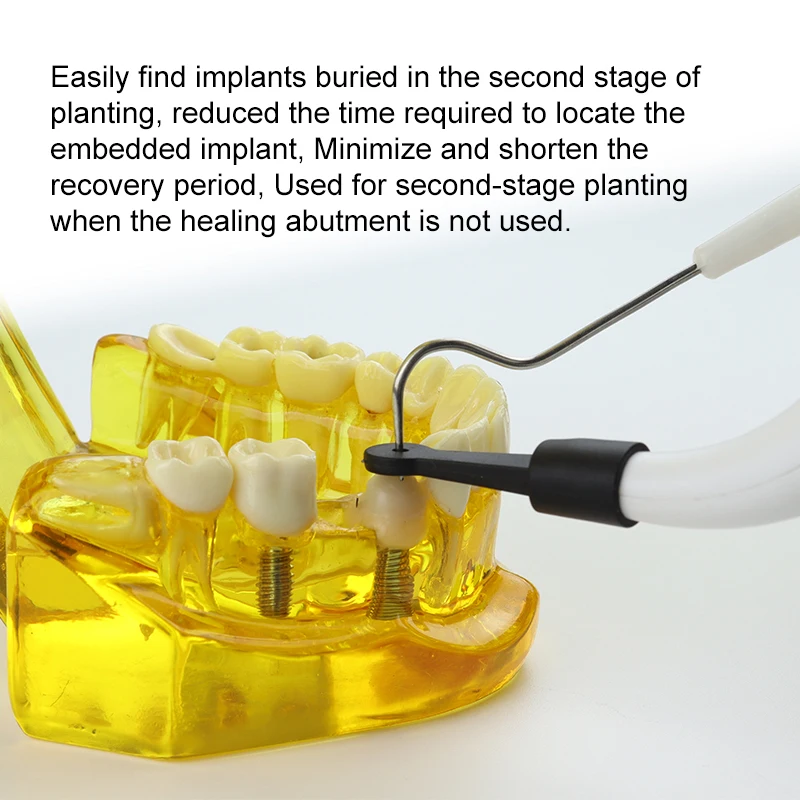 VVDental Implant Locator 3-Schritt-Schnellpositionierung zum Auffinden von Implantatschrauben 360° drehbar mit 4 Sensorsonden Lokalisierungswerkzeuge – Detail 6