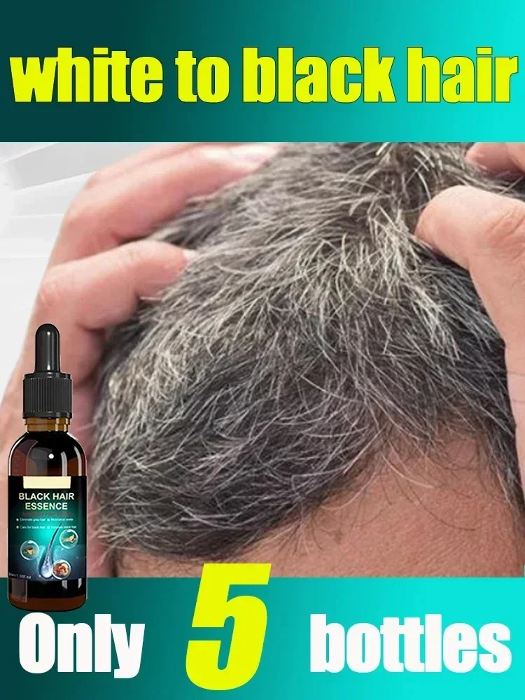 

White hair treatment essence quickly turns white hair into black, repairs natural color, and prevents gray hair products