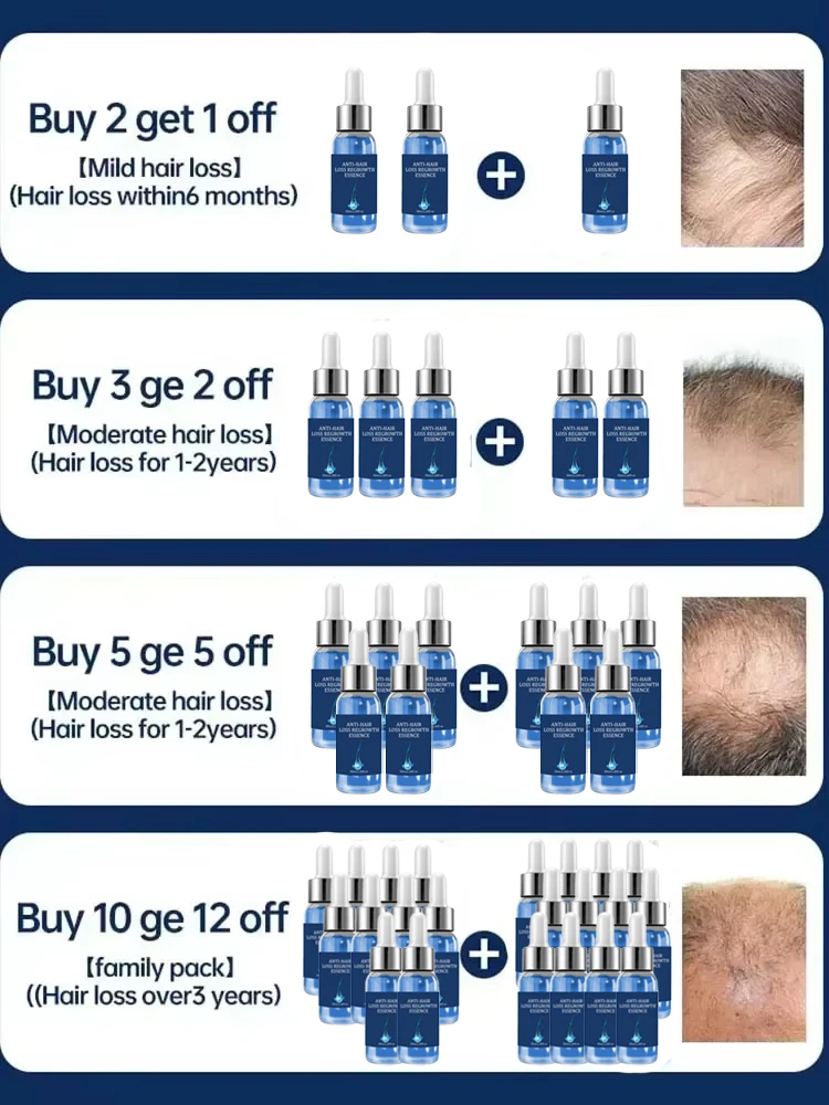 Effective Fast Hair Growth Oil Baldness Repair Hereditary Hair Loss Postpartum Hair Loss Seborrheic