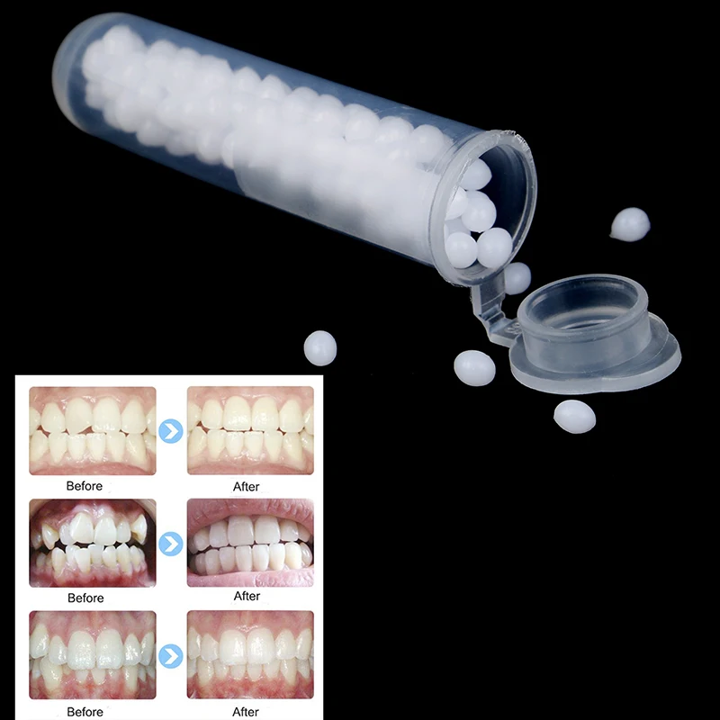 Novo kit de reparo temporário de dentes, dentes e lacunas, cola sólida, adesivo para dentadura, clareamento dos dentes, resina, ferramenta de beleza