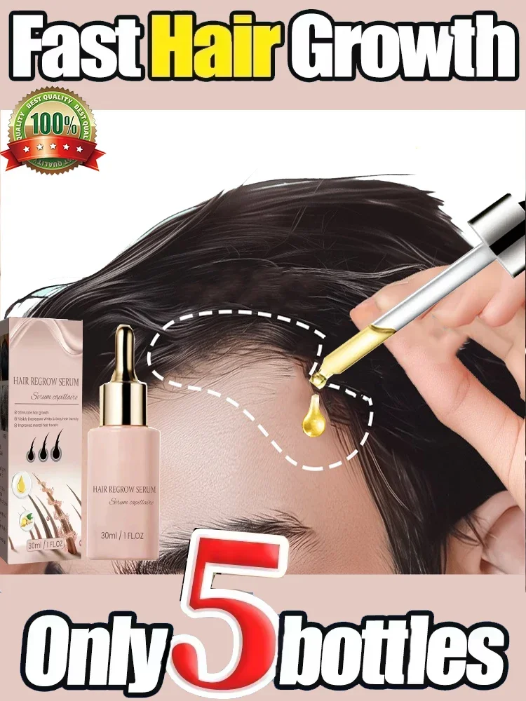 

Effective Fast Hair Growth Serum Baldness Repair Hereditary Postpartum Seborrheic Anti Loss Care for Men Women Scalp Cares1