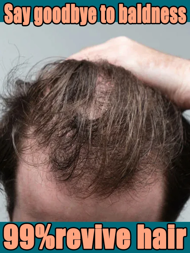 

100% revive hair, strong penetration, activate hair roots, more hair, say goodbye to baldness, thick hair