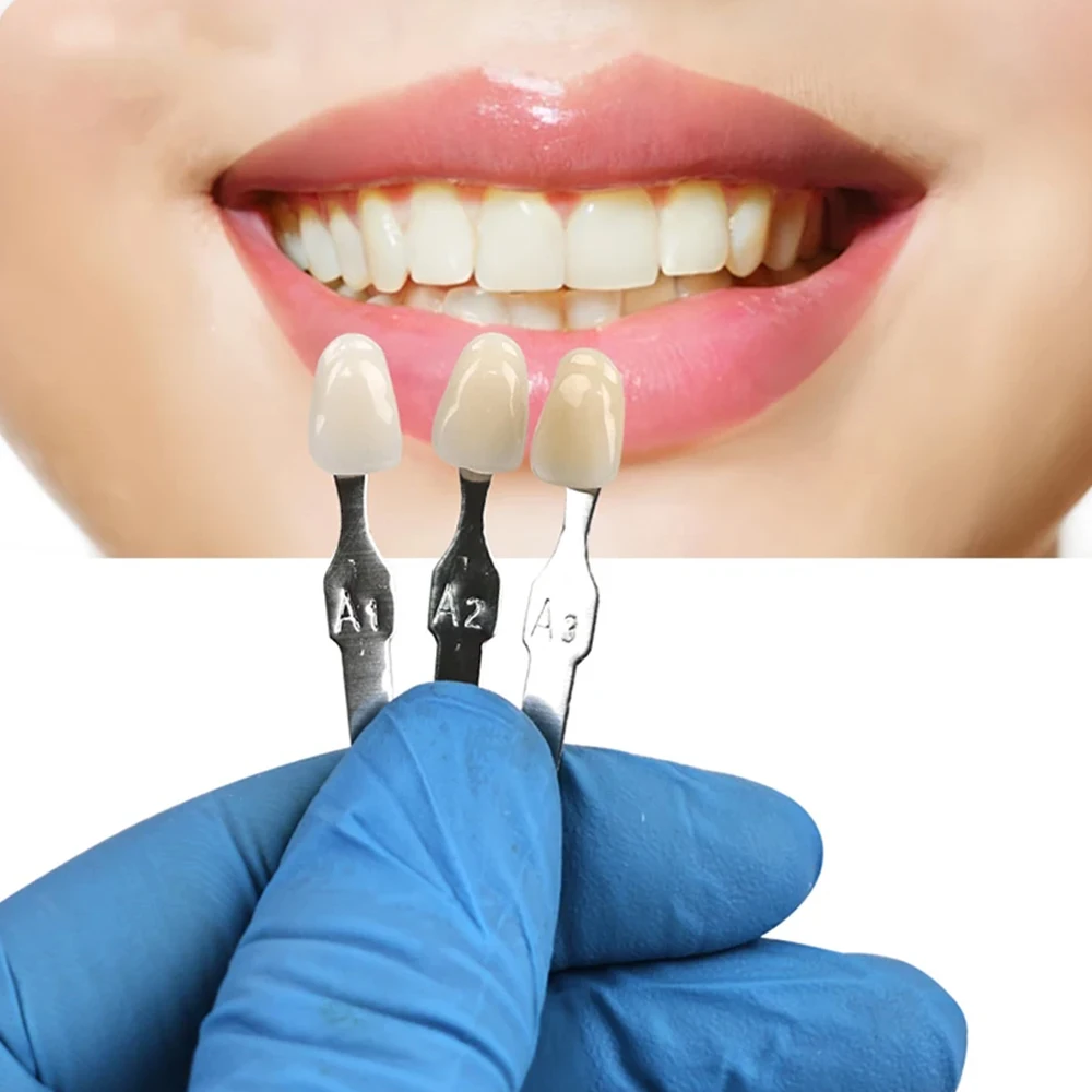 

Стоматологическое оборудование PIORPOY, фарфоровая сковорода для отбеливания зубов, классическая 16-цветная направляющая, модель зуба Vita, модель колориметрической пластины