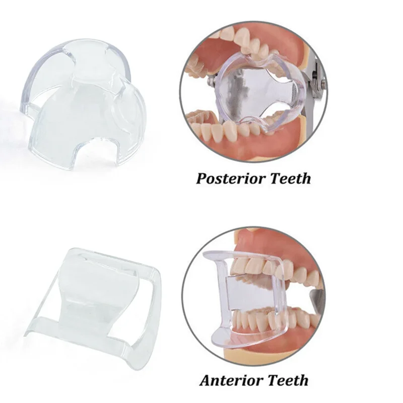 

10Pcs Mouth Opener Dental Orthodontic Lip Cheek Retractor Expander Dental Mouth Accessories For Anterior Teeth Posterior Teeth