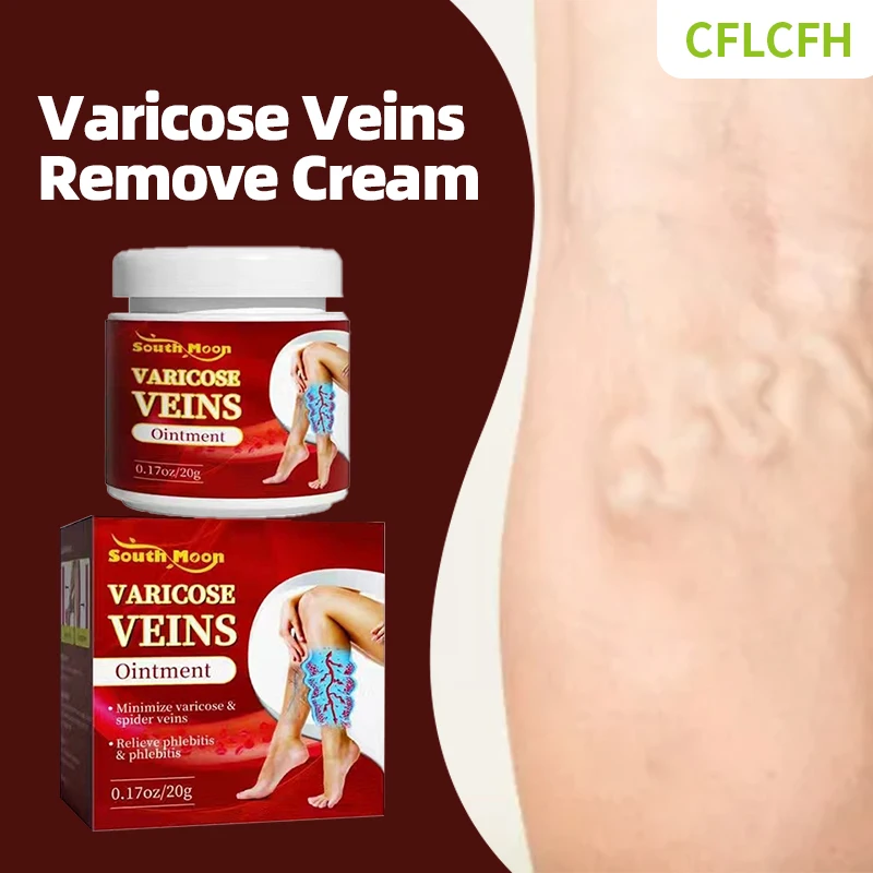 

Varicose Veins Relief Foot Care Cream Vasculitis Phlebitis Treatment Patch Spider Leg Varicosity Angiitis Legs Dilated Medicine