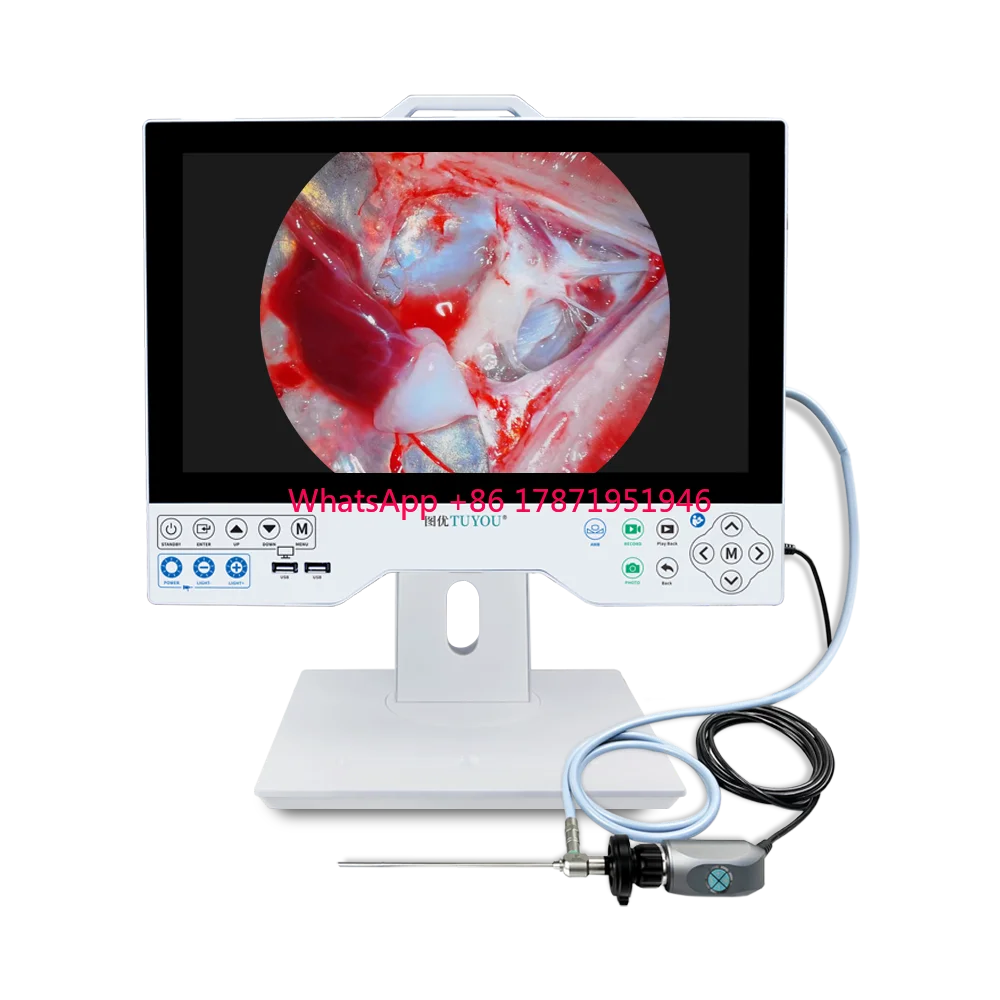 All In One FHD 15.6 Inch Endoscope Camera  System And Monitor