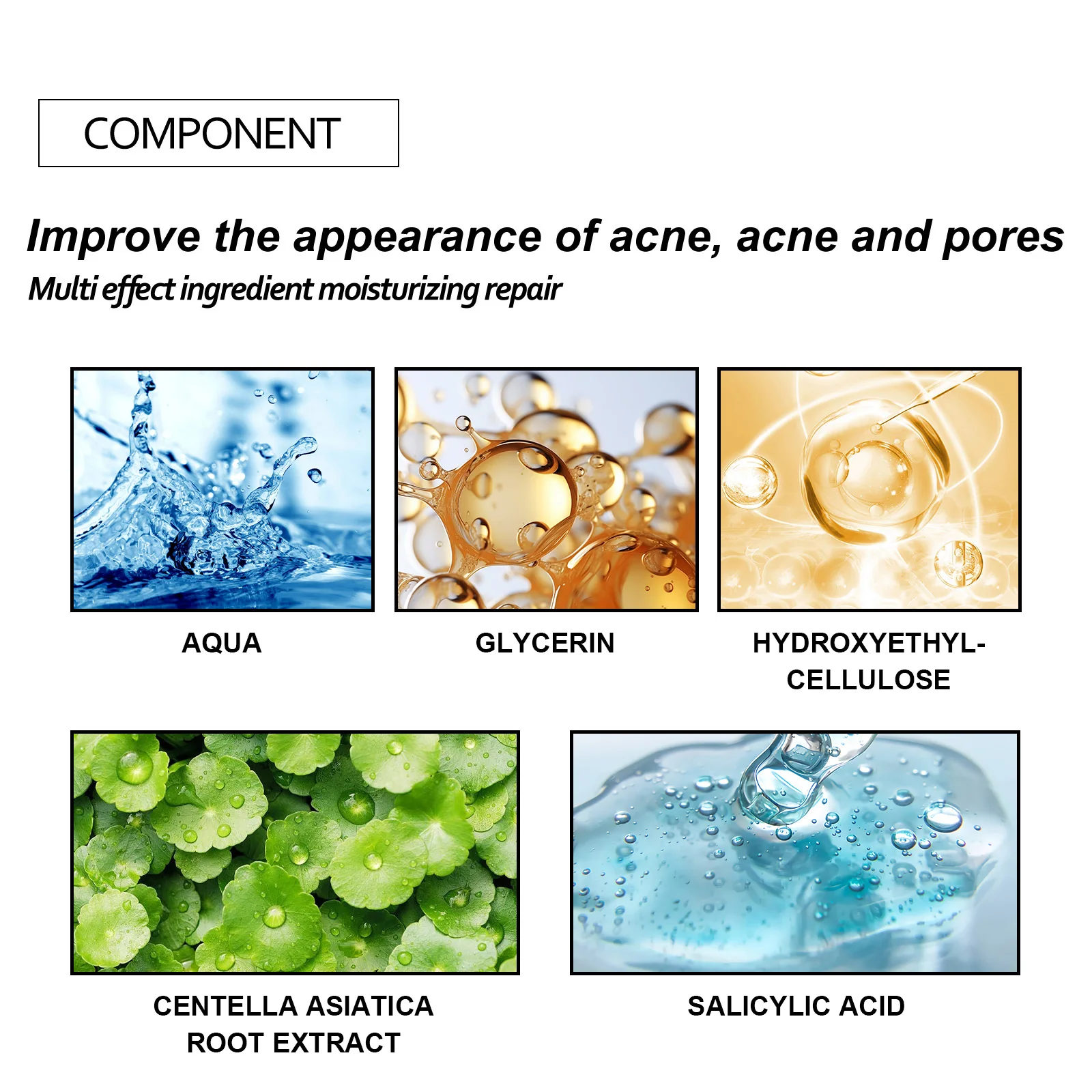 Parches suaves para el acné, tratamiento hidrocoloide calmante para imperfecciones, parches para espinillas respetuosos con la piel para pieles sensibles