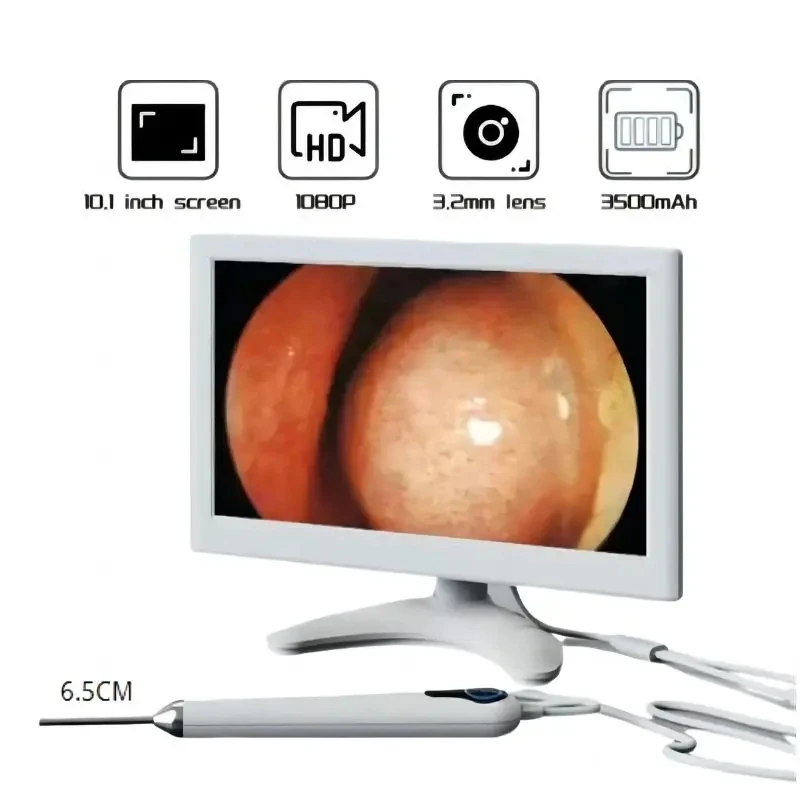 

Digital Otoscope 3.2mm Lens with 1080P HD 10.1 Inches Screen Ear Scope ENT Endoscope Ear Cleaner Tools 3500mAh Battery